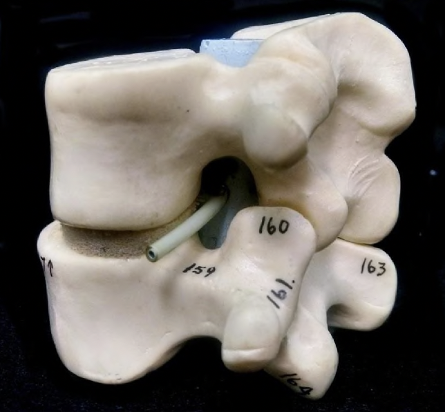 <p>what articulated vertebrae are pictured</p>