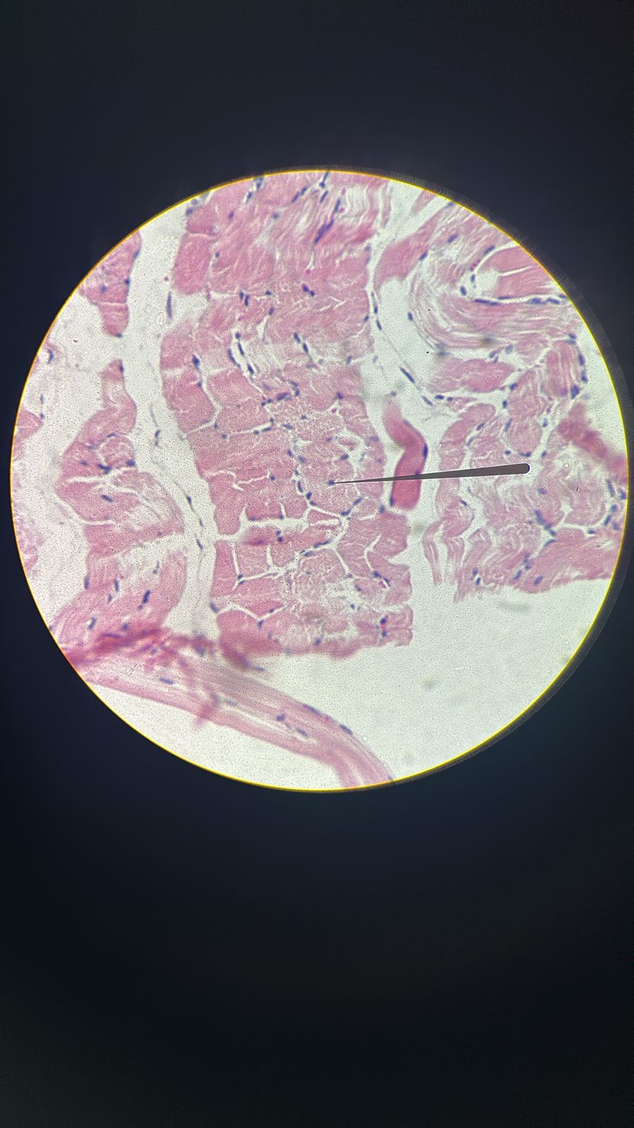 term image