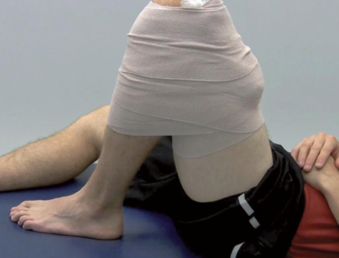 <p><span style="color: red;"><strong>Knee brace positioned of maximally tolerated flexion</strong></span></p><ul><li><p><span style="color: red;"><strong>24 hrs in 120 degrees flexion</strong></span></p><ul><li><p>Better if initiated within 10 minutes of injury**</p></li></ul></li><li><p><span style="color: red;">Avoid massages and NSAIDs</span></p></li></ul><p></p>