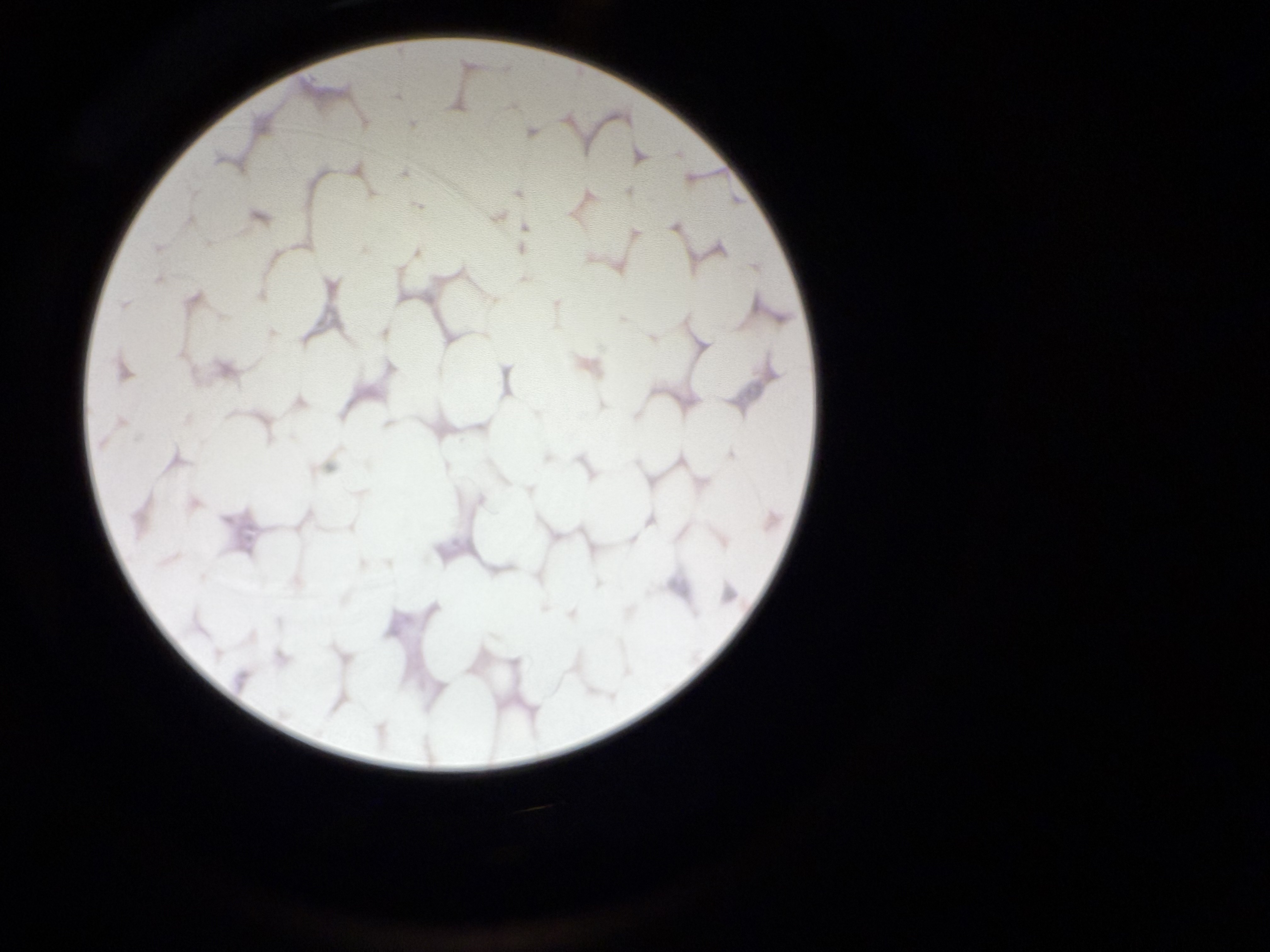 <p>tissue location </p>