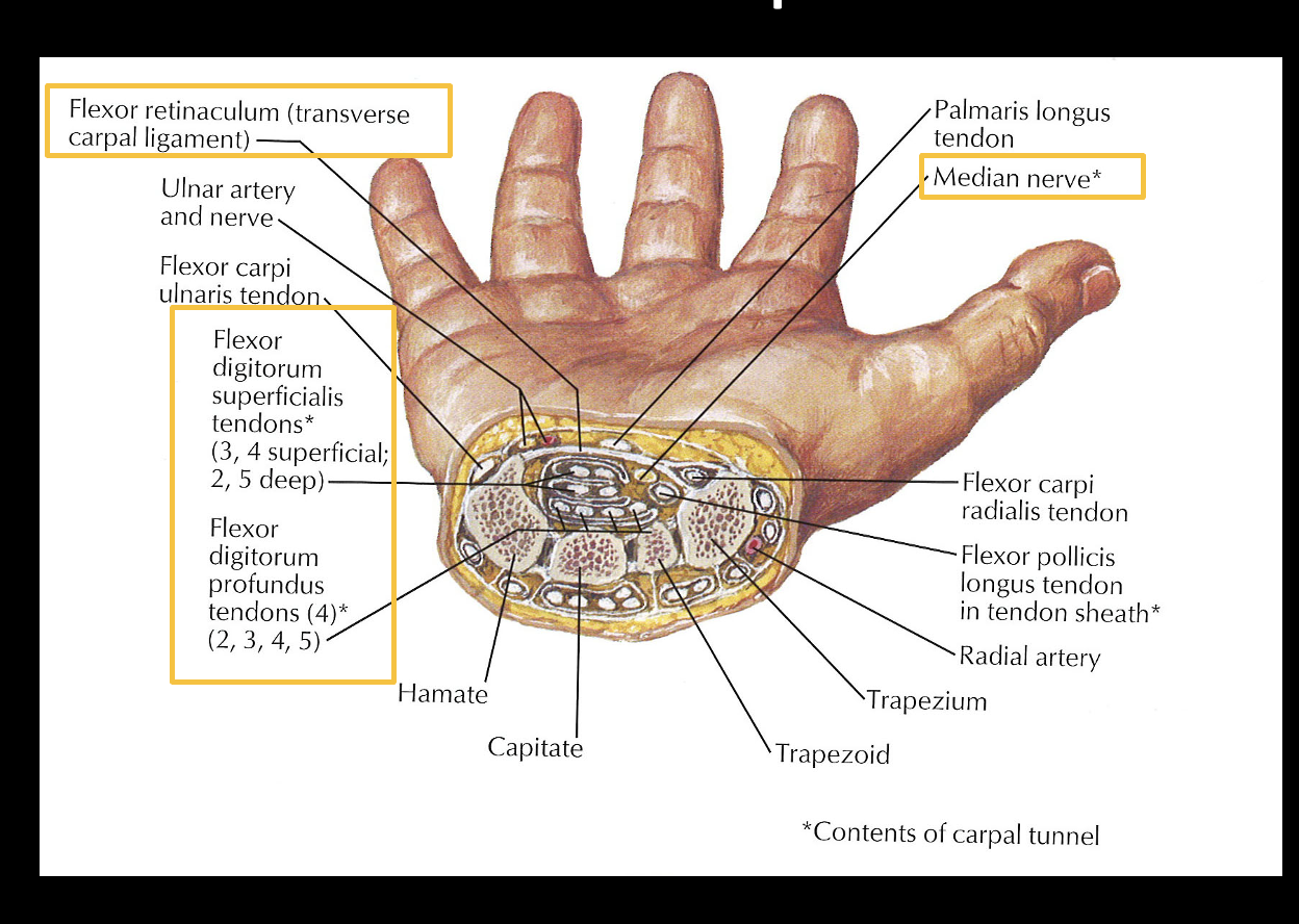 <p>-Cylindrical space tendons and median nerve pass through</p><p><u>Boundaries</u></p><p>-Floor: Hamate, capitate, trapezoid</p><p>-Medial wall: Hamate</p><p>-Lateral wall: Trapezium</p><p>-Roof: Hook of hamate, flexor retinaculum attached to trapezium (*retinaculum rigid)</p><p><u>Content</u></p><p><mark data-color="green" style="background-color: green; color: inherit;">-10 contents</mark>=4 tendons FDS, 4 tendons FDP, tendon Flexor Pollicis Longus, median n</p><p><u>Injury</u></p><p>-inflammation or overuse impose on median n</p><p>-Phalen’s test or Tinel’s test reproduce symptoms</p>
