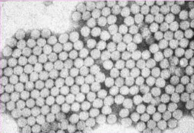 <p>What is this Waterborne Virus?</p><p>-<strong>ssRNA </strong>naked virus with <strong>icosahedral capsids</strong></p><p>-Enters<strong> GI tract</strong> -> <strong>Epithelial cells</strong> -> <strong>Blood stream</strong> -> <strong>Liver</strong></p><p>-<strong>Fever, malaise, nausea, jaundice</strong></p><p>-Very<strong> slow recovery (weeks)</strong> to<strong> repair liver damage</strong></p>