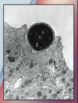 <p>type of Endocytosis</p><p>“Cell <strong>eating</strong>”</p><ul><li><p><strong>Large</strong> vesicles</p></li><li><p>Consume Microorganisms and cell debris</p></li></ul><p></p>