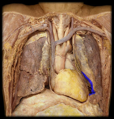 <p>Identify the part of the lung</p>