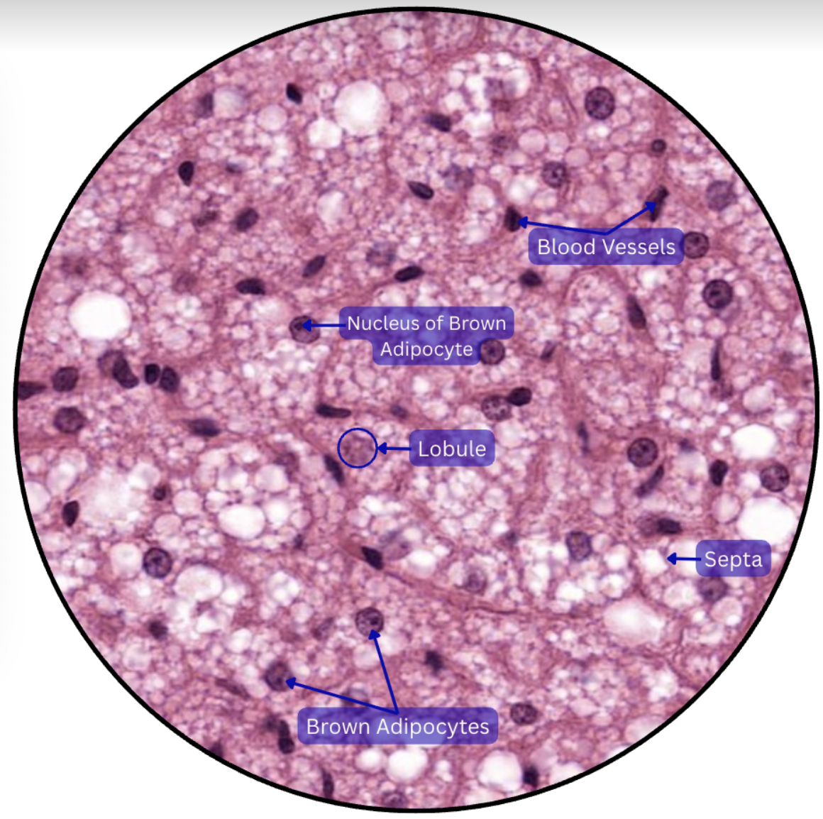 <p><span style="background-color: transparent;"><strong>BROWN ADIPOSE TISSUE</strong></span></p>
