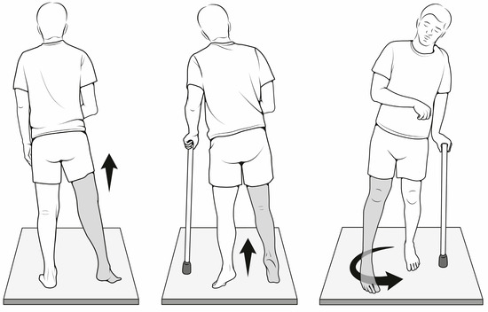 <ul><li><p><span>Due to global weakness of the leg</span></p></li><li><p><span>Leg swings forward</span></p></li></ul><p></p>