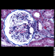 <p>this is a highlighted image of?</p>