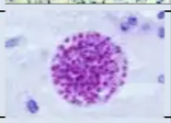 <p>Identify</p>