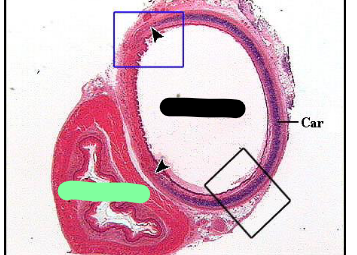 <p>Identify black </p>
