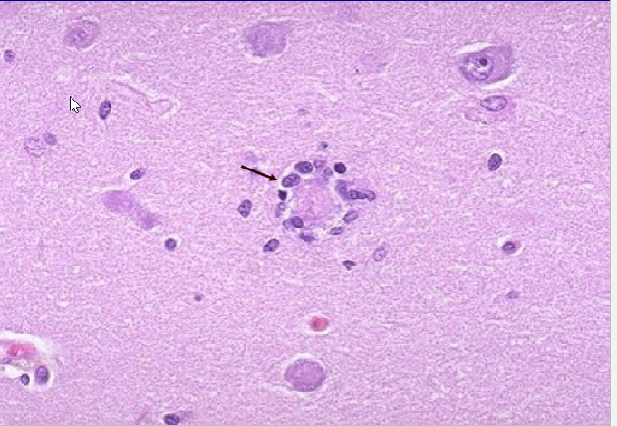 term image