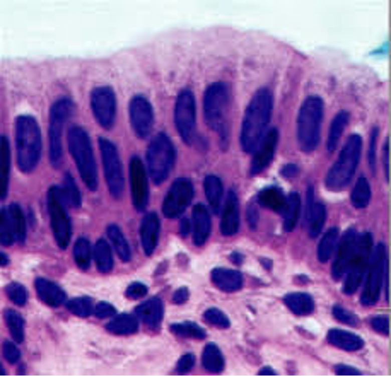 <p>urinary system</p>