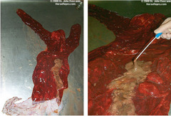 <p>What type of placentitis is this?</p>