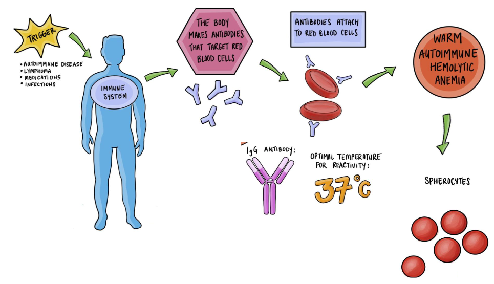 <p>Immune Haemolytic Anaemia</p>