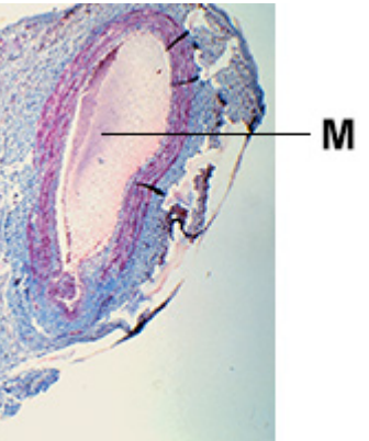 <ol><li><p><strong>thin</strong> elastic and muscle tissue as pressure is <strong>lower</strong></p></li><li><p>wide lumen </p></li><li><p><strong>valves</strong> to prevent <strong>backflow</strong> of blood</p></li></ol><p></p>