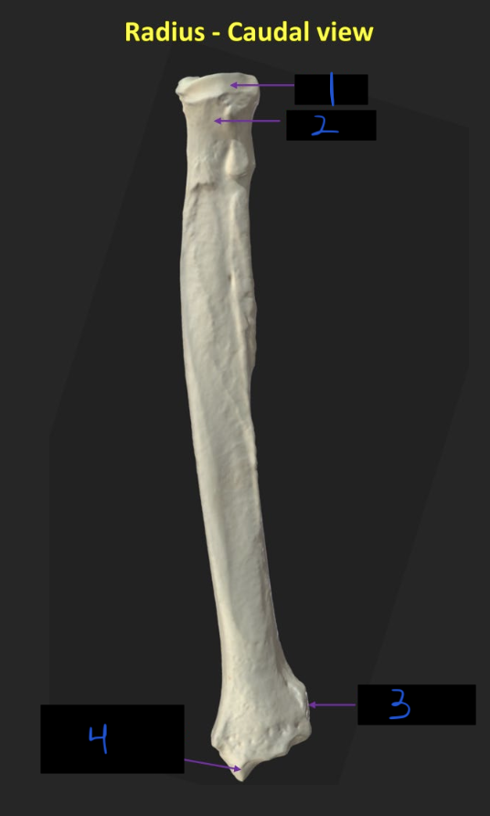 <p>Name these parts of the radius</p>