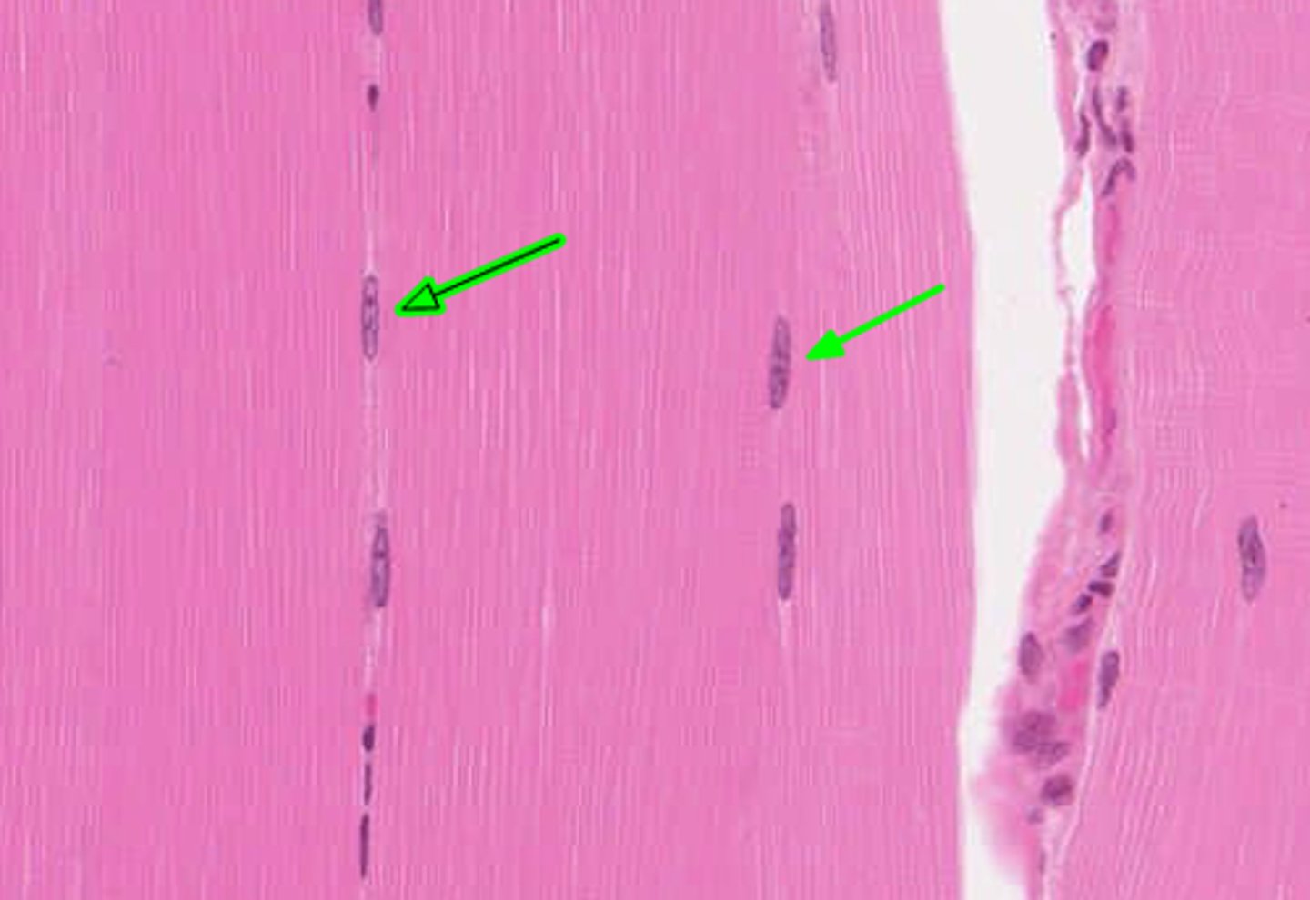 <p>Multiple nuclei located at the edge of muscle fibers.</p>