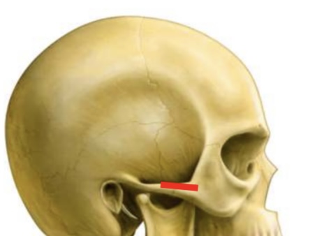 <p>Zygomatic arch </p>