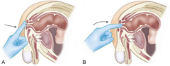 <p>Digital rectal examination (DRE) and PSA testing.</p>