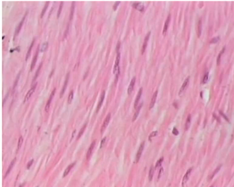 <p>involuntary, found in the wall of internal organs (gut, blood vessels), spindle shaped, uninucleated cells, not striated</p>