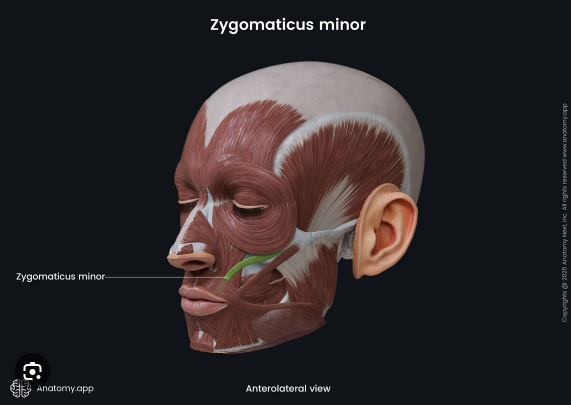 <p>zygomaticus minor</p>