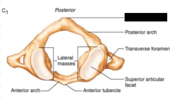 <p>What part of the atlas (C1) is this?</p>