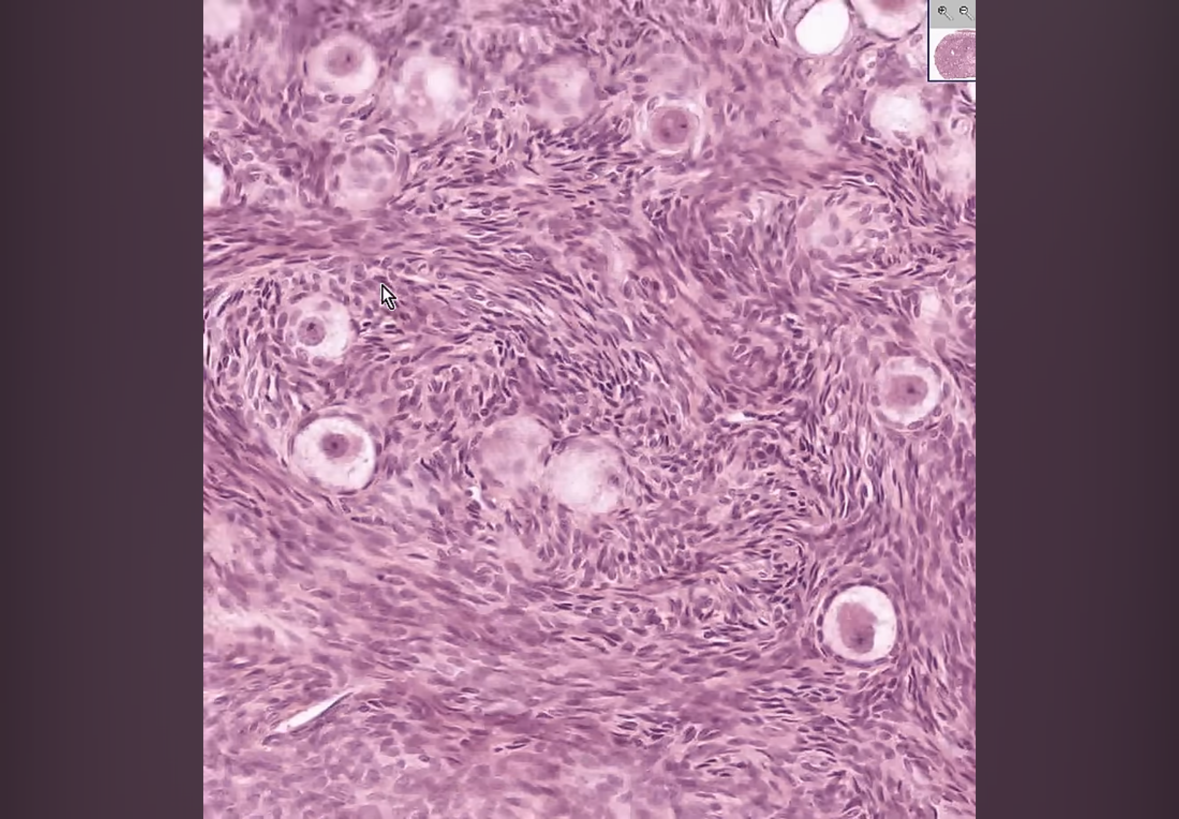 <p>What kind of follicle is this &amp; why?</p>