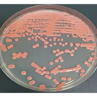 <p>Which of the following species of fungus is usually encapsulated and urease positive and typically produces mucoid, red colonies?</p><p>Crytococcus neoformans</p><p>Rhodotorula rubra</p><p>Saccharomyces cerevisiae</p><p>Trichophyton rubrum</p><p>Trichosporon beigelii</p>