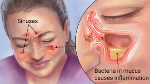 <p>bacteria love fluids and … to keep an … balance, meaning they grow best in … filled areas and easily cause …</p>