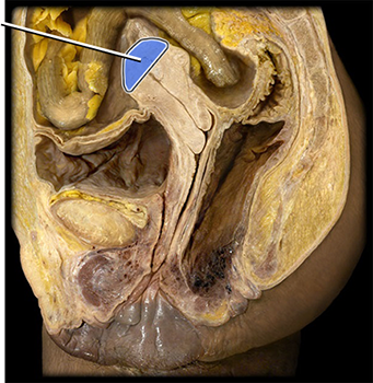 <p>what structure is highlighted?</p>