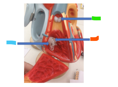 <p>What is the blue arrow?</p>
