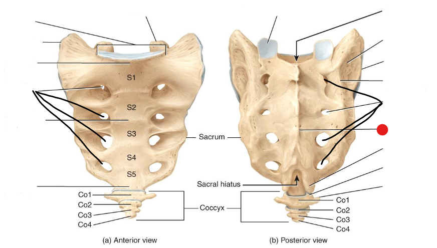 <p>Identify the structure pinned </p>