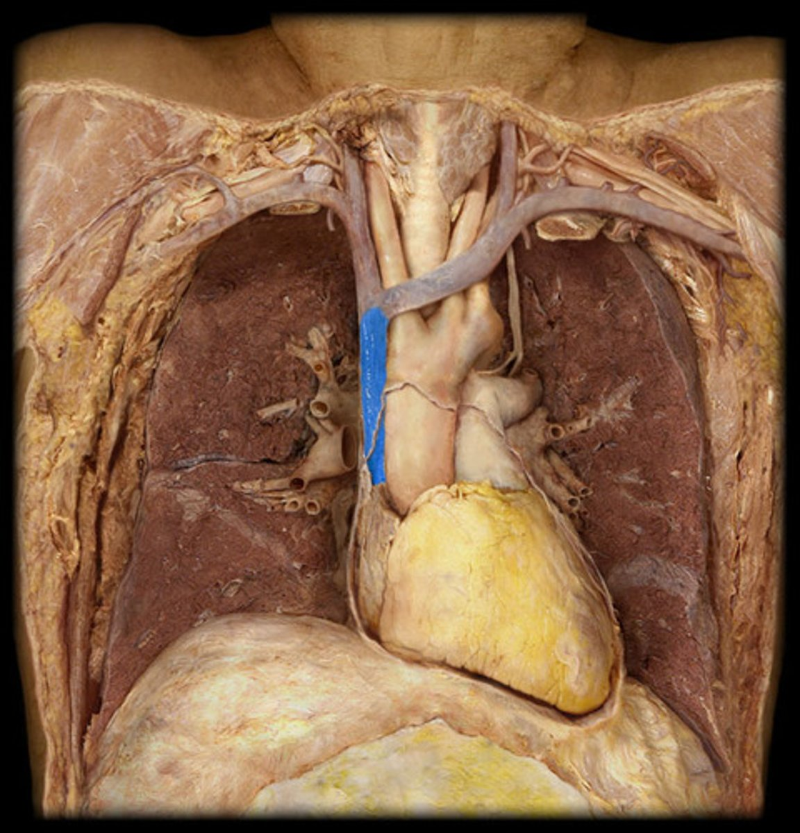 <p>Superior vena cava</p>