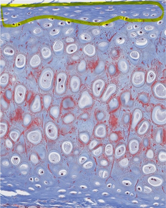 <p><span style="font-family: "Calibri Light";">What do we call the CT capsule that surrounds hyaline & elastic cartilage?</span></p>