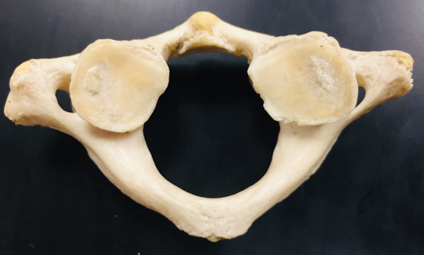<p>C1 or atlas, traverse foramina, articulating process, vertebral foramen, transverse process, intervertebral foramen</p>