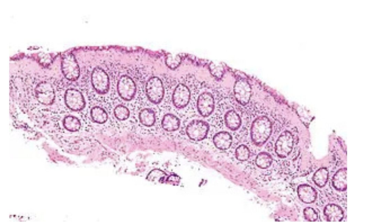 <p>1) diagnostic</p><p>2) histologie</p>