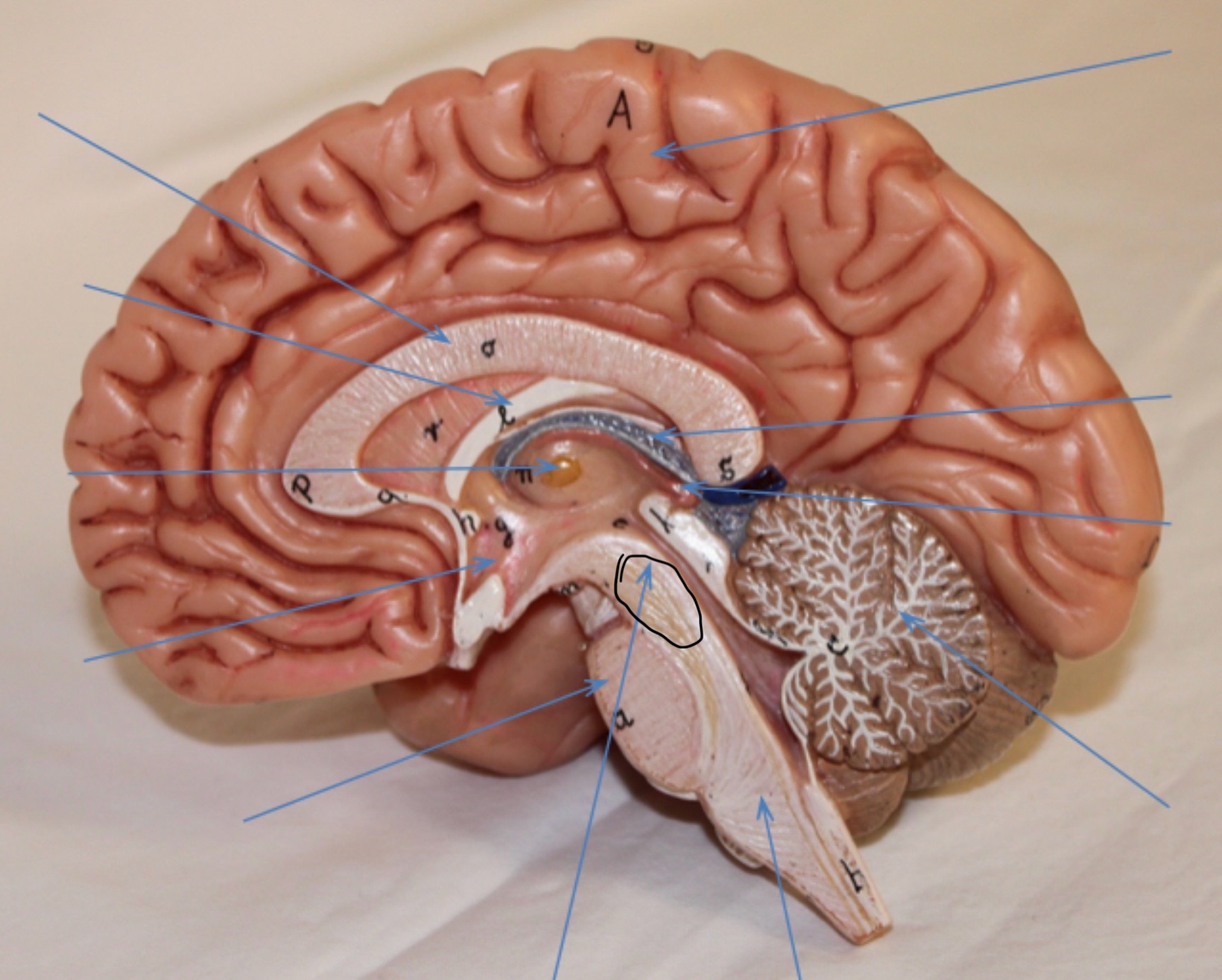 <p>Identify the circled area?</p>