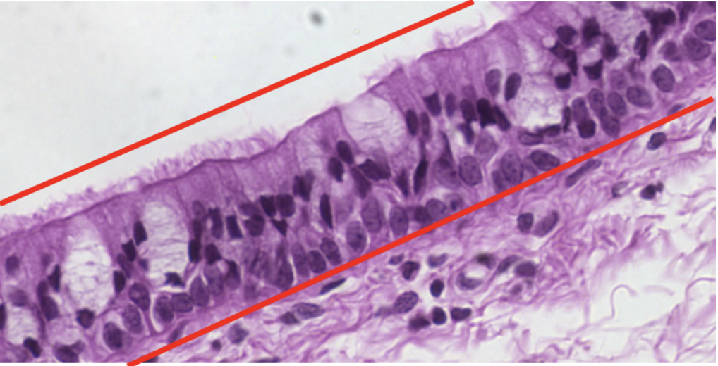 <p>Identify the tissue seen between the red lines</p>