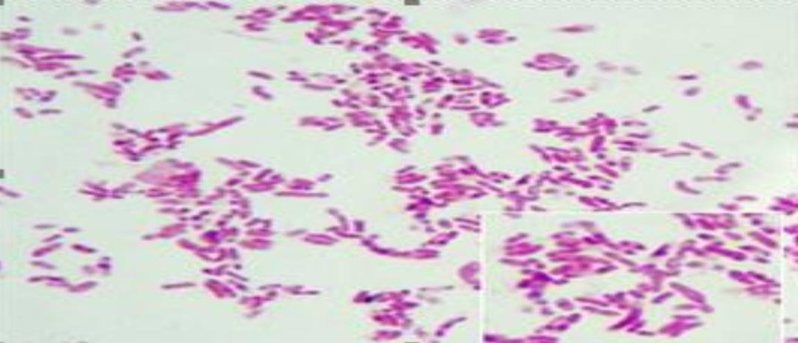 <p>Specimen (microscopically slide):</p><p>• Name of organism:</p><p>• Stain:</p><p>• Sample from: culture or pus or in tissue</p><p>• Morphology</p>
