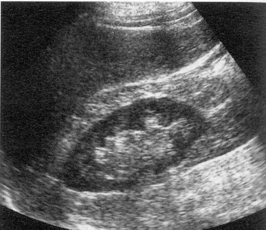 <p>What organs are show in this ultrasound?</p>