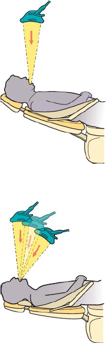 <p><strong>Madibular arch light position</strong></p><ul><li><p>Light perpendiular to floor — directly over oral cavity</p></li><li><p>Patient in chin down position</p></li><li><p>Light is arm’s length</p></li><li><p>Avoid too close to patient’s head </p></li></ul><p></p><p><strong>Maxillary arch light position</strong></p><ul><li><p>Light directly over or around patient’s neck</p></li><li><p>Patient is in chin up position</p></li><li><p>Light is arm’s length</p></li><li><p>Light beam angled perpendicular to floor or 60—90 degrees to floor</p></li></ul><p></p><p></p><p></p>