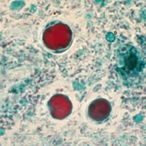 <p>5-15 um, up to 4 nuclei, large central vacuole takes up 90% of cell volume, push nuclei to side</p>