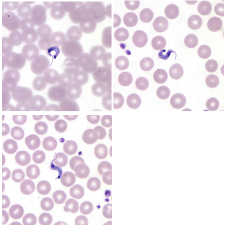 <p>Trypanosoma cruzi, trypomastigote</p><p>Disease: <u>Chagas disease</u></p><p>Vector: <u>Triatomine/kissing/reduviid bug</u></p><p>Transmission: <u>bugās feces</u></p><p>Infective stage: <u>Metacyclic trypomastigote</u></p><p>Diagnostic stage: <u>Trypomastigote</u></p><p>Treatment: <u>Benznidazole and/or Nifurtimox</u></p>