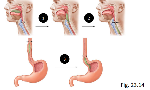 <ol><li><p>buccal phase (voluntary)</p></li><li><p>pharyngeal phase (involuntary form here)</p></li><li><p>esophageal phase</p></li></ol><p></p>