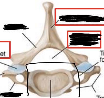 <p>What is this part of the vertebrae?</p>
