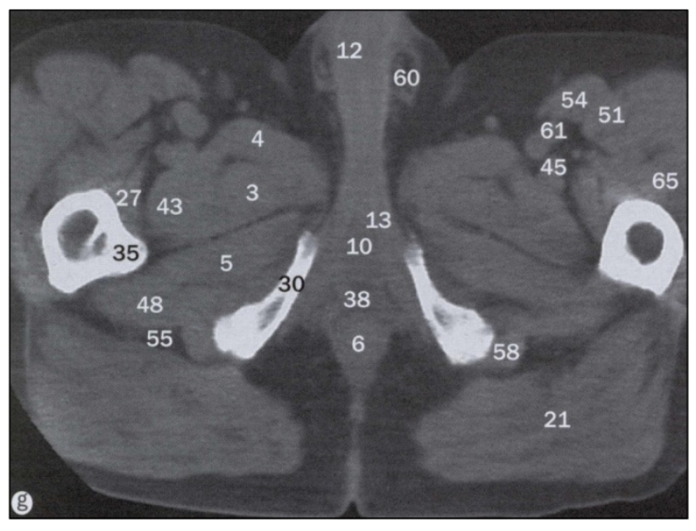 term image
