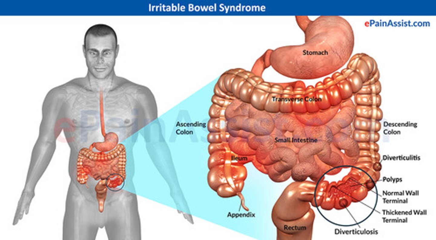 <p>Irritable bowel syndrome (IBS)</p>