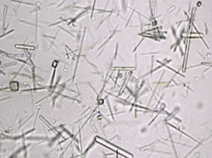 <p>what crystal; acid or alk</p>