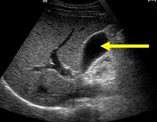 <p>what organ scan is this?</p>