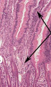 <p>what are arrows pointing to (jejunum)</p>
