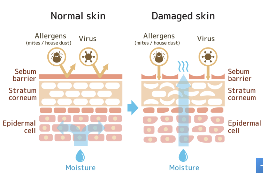 <p><strong>10. In damaged skin, epidermal cells appear:</strong> </p><p>A. Tightly packed<br>B. Organized<br>C. Separated and irregular<br>D. Larger and stronger</p>